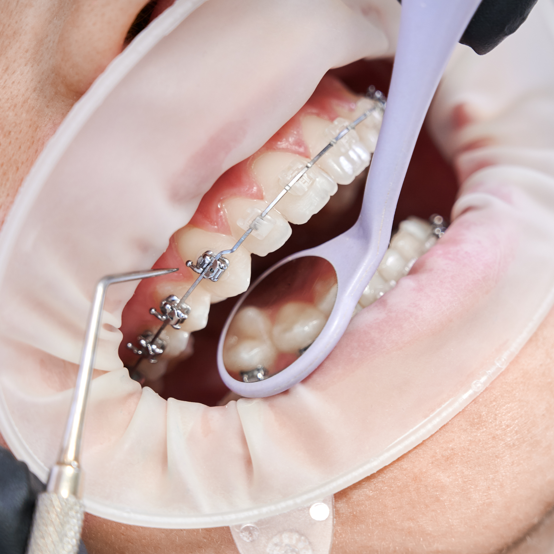 service-ortho-DlbWMcaO