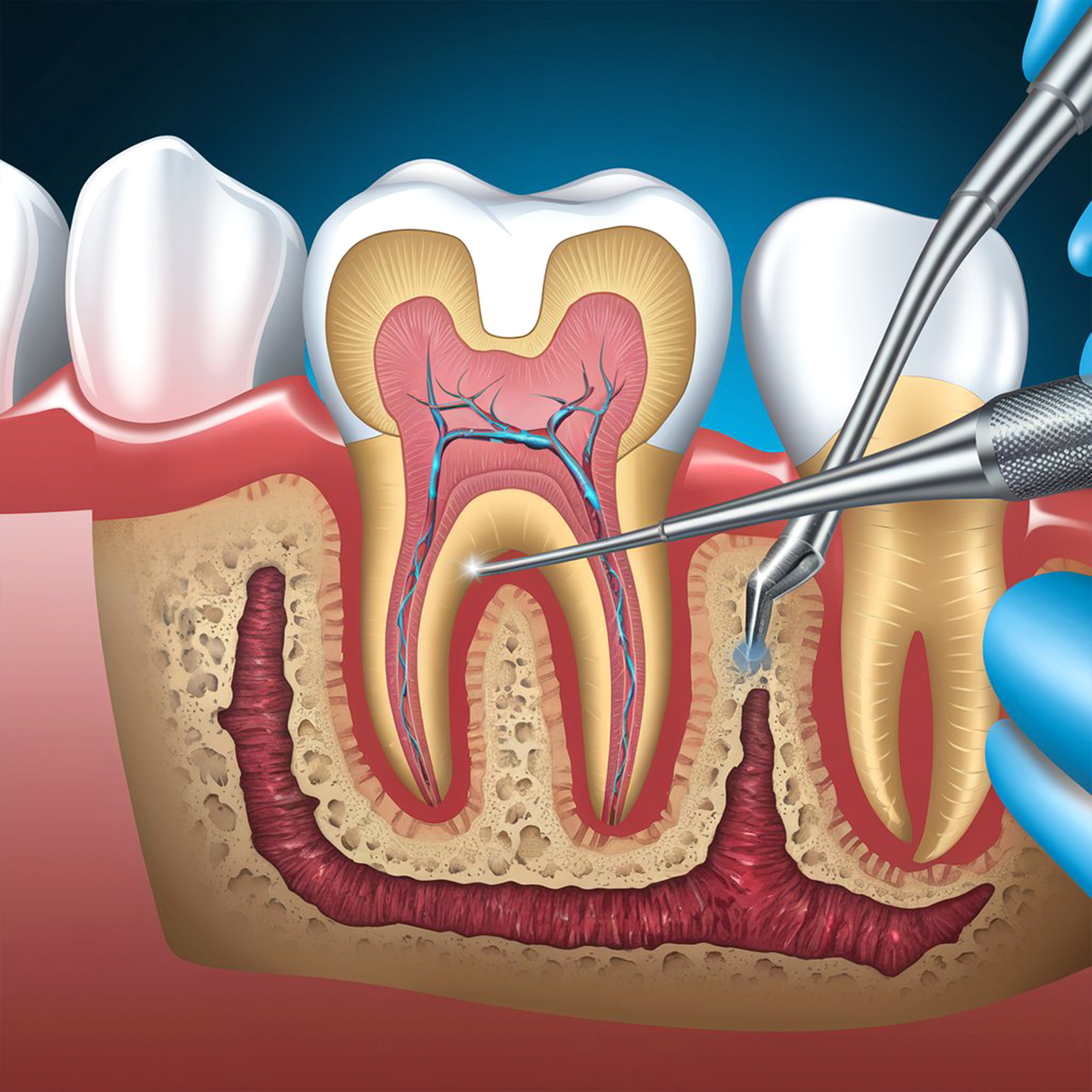 service-rootcanal-4053__y8