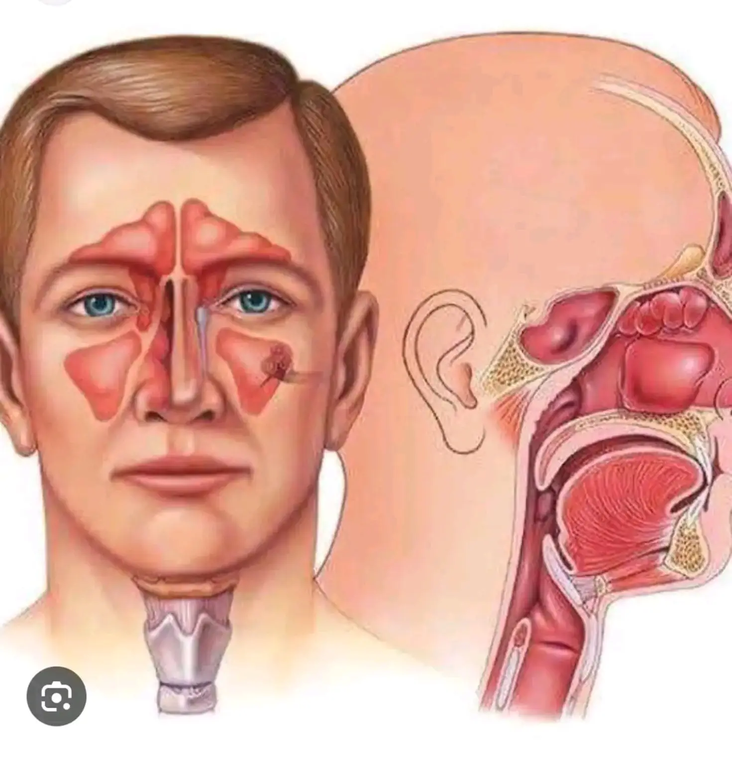 sinus_image_compressed
