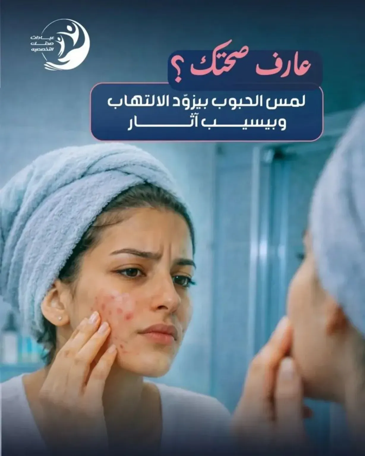 acne_post
